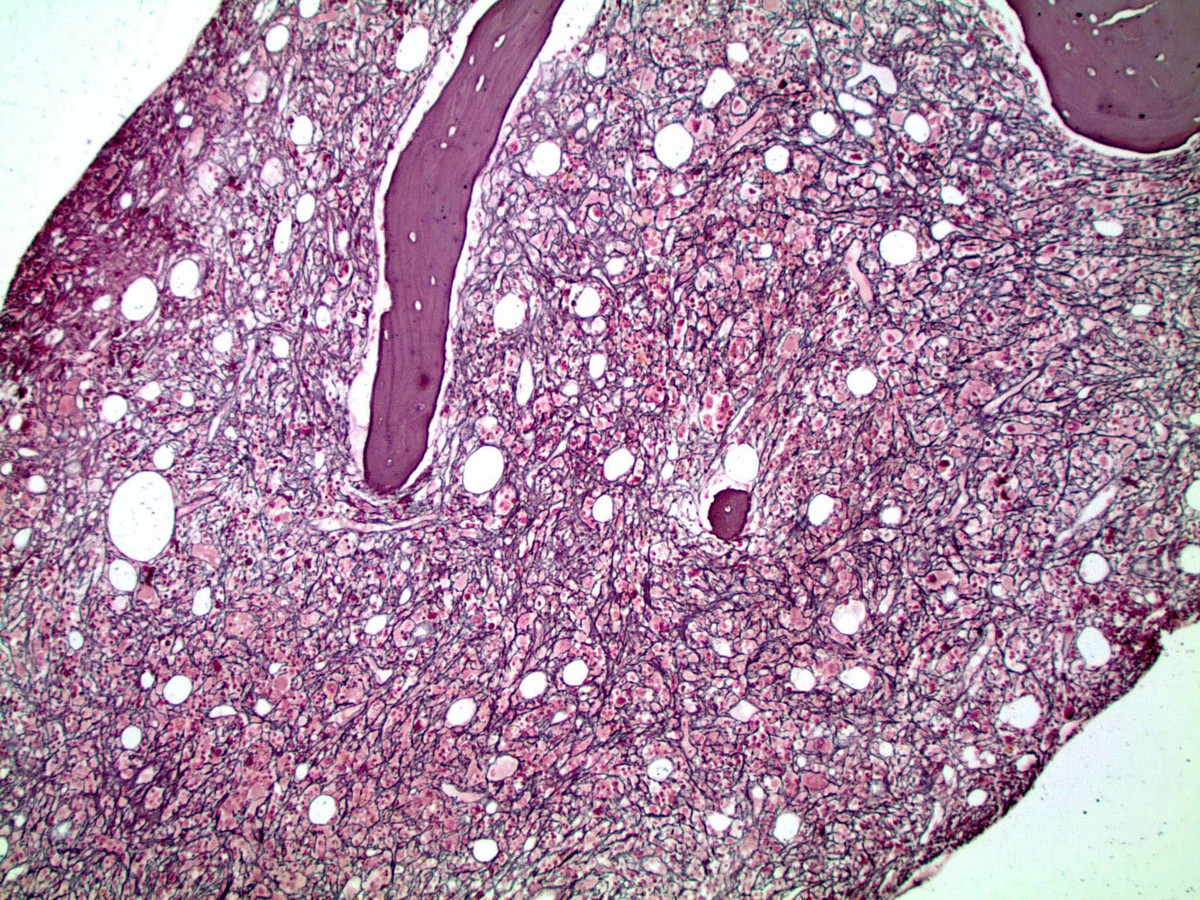 Reticulin 100X